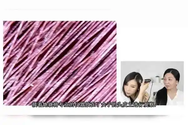 显微镜下的头发是什么样子的小姐姐带你见识一下放大后的头发