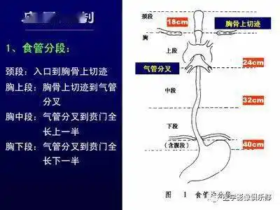 上消化道造影检查技术及常见病变的x线诊断_食管