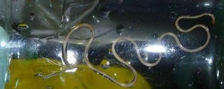铁线虫怎么杀死铁线虫会寄生在人体吗