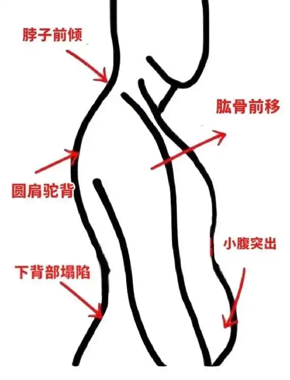 背薄一寸,年轻十岁.含胸驼背,骨盆前倾,小腹突 - 抖音