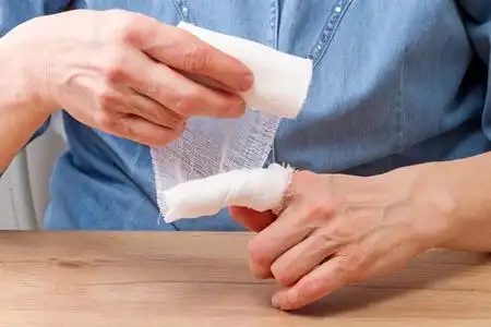 女人用绷带包扎她的手指照片