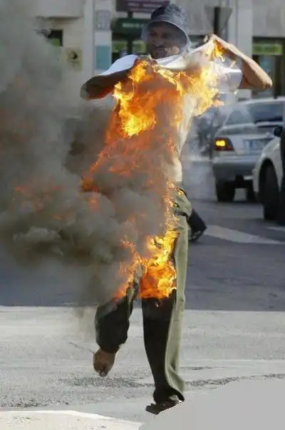 世界最令人困惑的未解之谜之人体自燃之谜