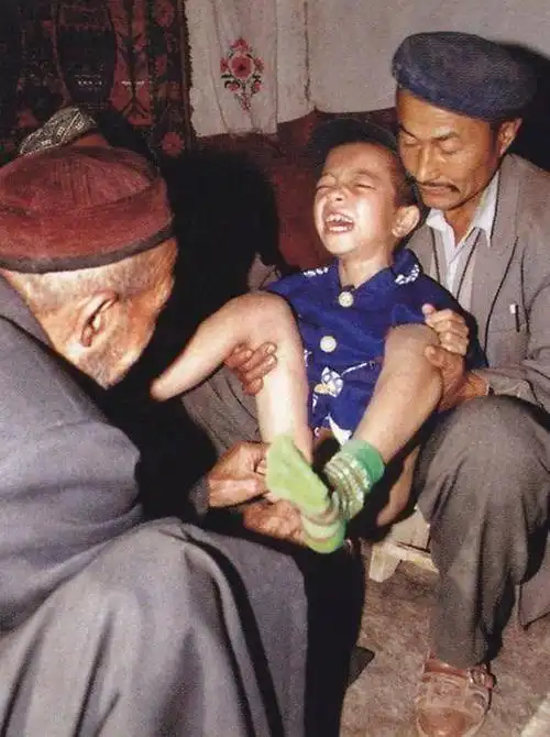 为什么穆斯林要给男性割礼