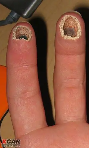 转一张超级恐怖的图片(承受力差的千万别进)吓倒不怨俺