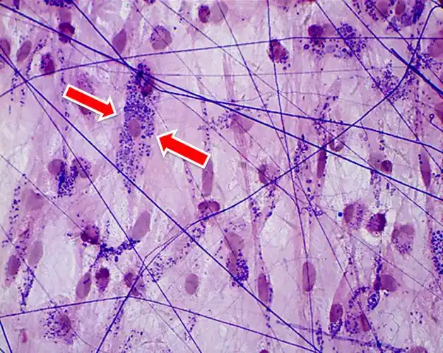 规则致密结缔组织c: 脂肪组织d: 网状组织e: 疏松结缔组织答案:疏松