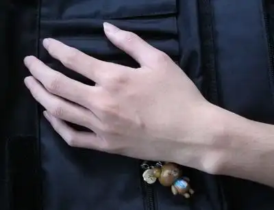 美莱整形注射玻尿酸除手背皱纹效果怎么样