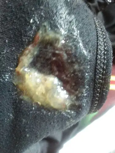 这个是宫颈黏液吗,是不是要生了?