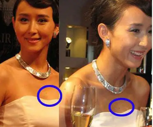 细数"胸有大痣"女明星