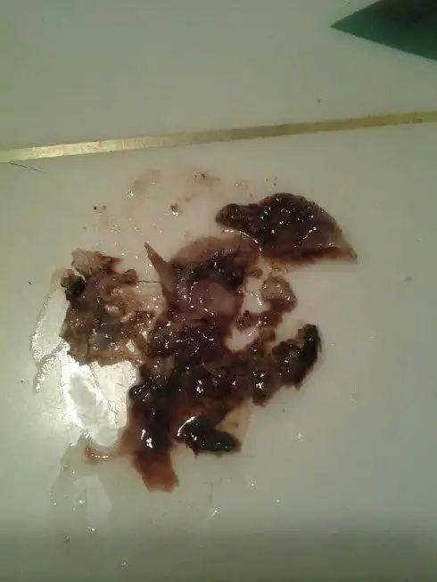 三八妇乐凝胶排出的毒素及反应解答-详细用法用量成分功效说明