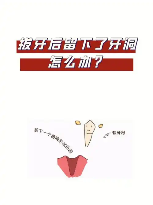 拔牙后的牙洞怎么办05怎样愈合得快
