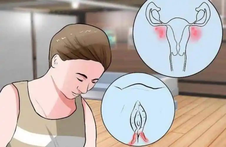 外阴_病变_白色