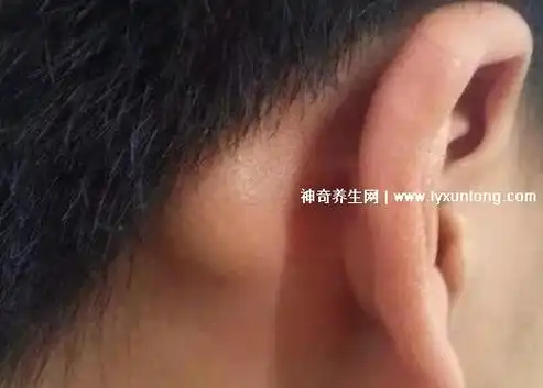 耳后淋巴结肿大图片