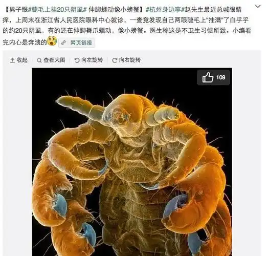 阴虱是什么东东竟然还能长到睫毛上