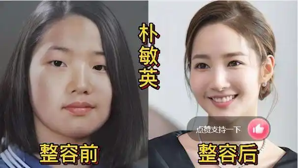 18位韩国女星整容前后对比