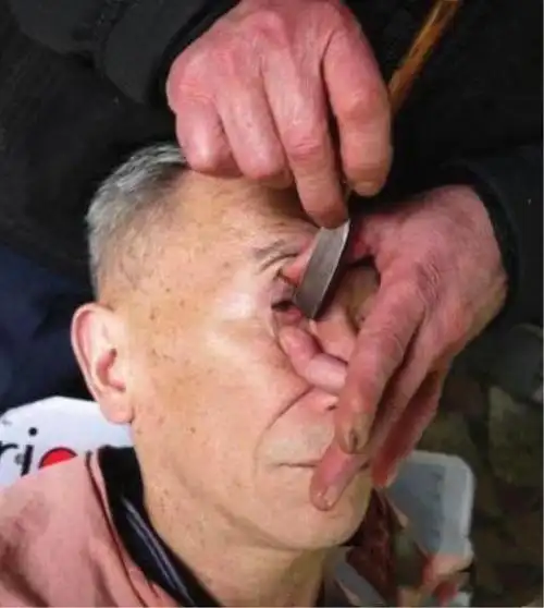 用剃刀洗眼睛恐怖奇葩不可思议不会割瞎我的双眼吧