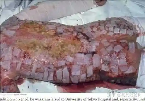 核辐射到底是个什么东西,为什么对人伤害这么大?