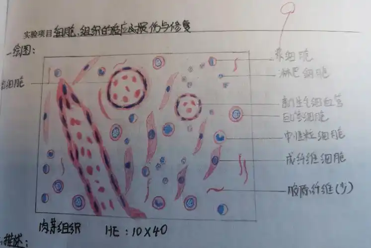 病理#病理报告  #病理学实验红蓝铅笔绘图  #肉芽组织  #慢性肺瘀血图