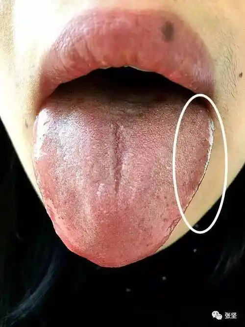 一:中医脾胃vs西医消化系统这个美女找我看舌头,我说你这个整体还好