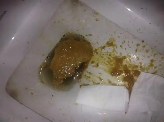 一拉发现好像很严重,全是黄黄的稀便.晚饭在饭堂吃,吃得很