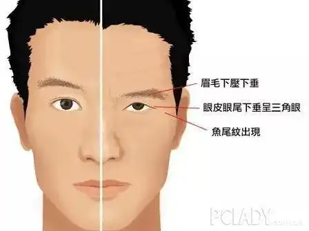 眼角下垂的男人女人面相具体如何 眼尾下垂-八字合婚网