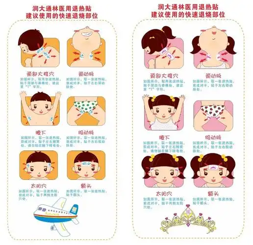 退热贴建议使用快速退烧部位如上图退热贴作为一种物理降温的辅助手段