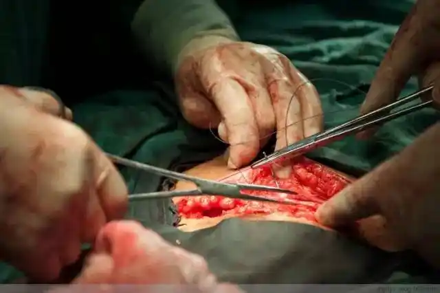 100张剖腹产手术照片,女人真的太伟大了!