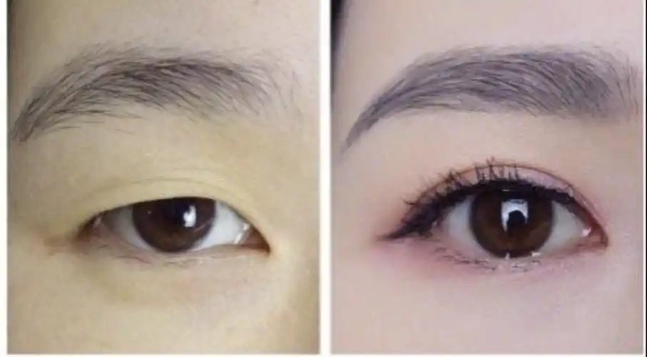 老师帮我看一下我的两个眼睛还有没有恢复到一样的可能我这是第一次