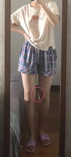 姐妹们 膝盖内侧这块可以减吗