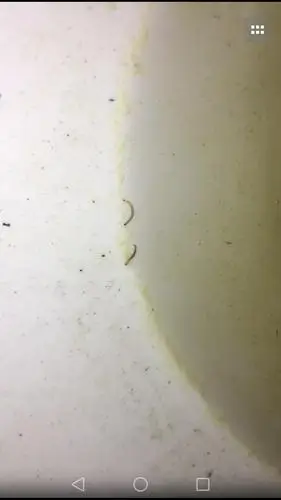 孩子6岁了,大便有虫子,请问吃什么药管用?