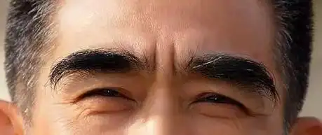 脸上出现这种纹代表你要转运了对照图片看看你有没有