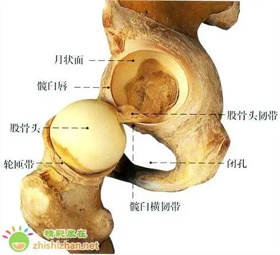 双侧骶髂关节炎是一种什么病呀