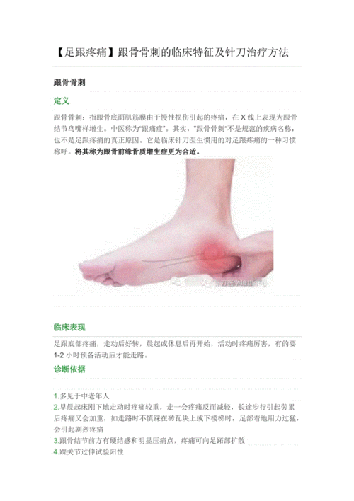 【足跟疼痛】跟骨骨刺的临床特征及针刀治疗方法.doc