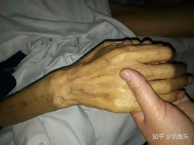 癌症晚期病人需要治 疗还是放弃?怎么才能有尊严的活着? - 知乎