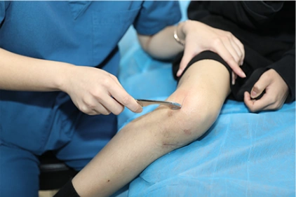 组成的胫骨关节;一个是由股骨(大腿骨)和髌骨(膝盖骨)组成的髌股关节