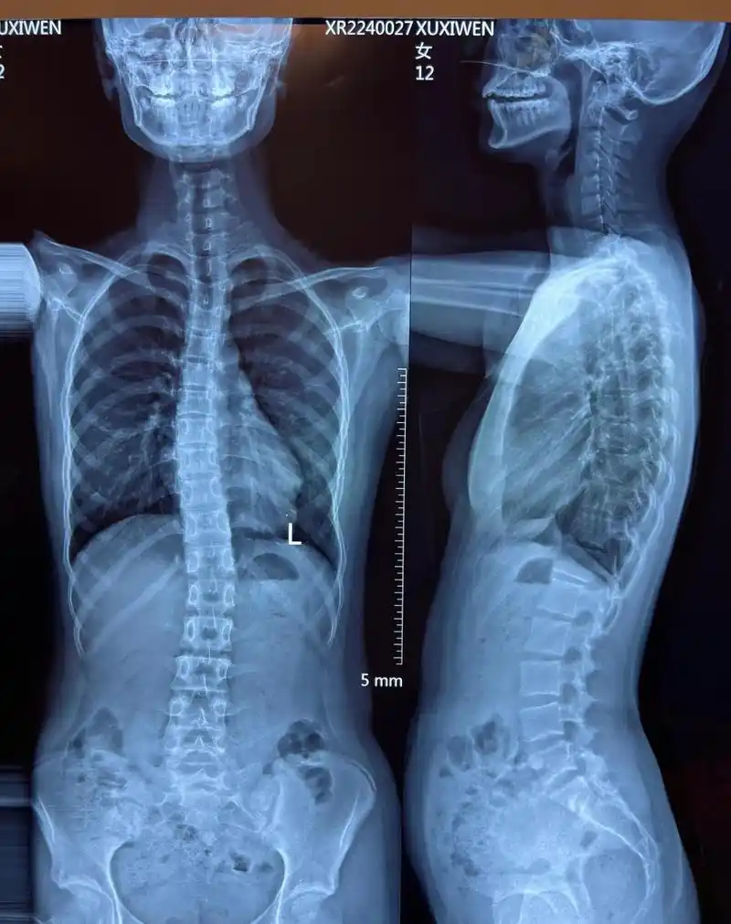 "医生,您不知道,我孩子的学校是西安的重点中学,作业太多了,根本