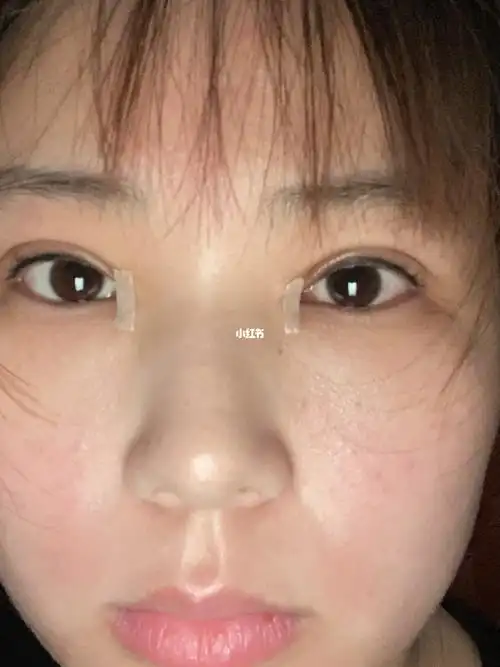 画眼妆的时候眼皮还是感觉麻麻肿肿的.没有下次了,等两个月的时候在