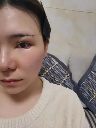 【术后第三天】