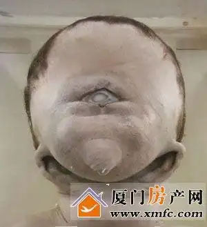 克隆失败的怪婴无脑儿是神经管畸形的一种.