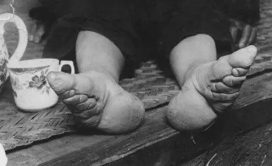 她15岁靠三寸金莲嫁入豪门每次洗脚时都痛苦丈夫却很喜欢