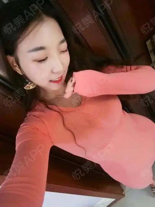 【圣嘉新自体脂肪隆胸】自体脂肪隆胸第19天,身体恢复.