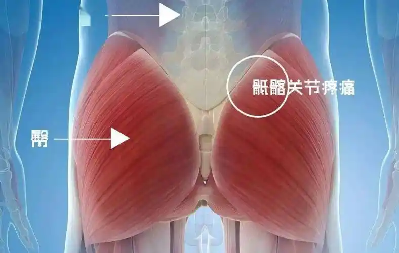 骶髂关节痛不明的腰痛屁股痛到底是啥
