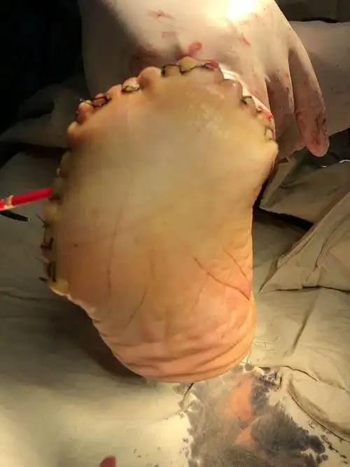 右前足离断术,解除患者痛苦