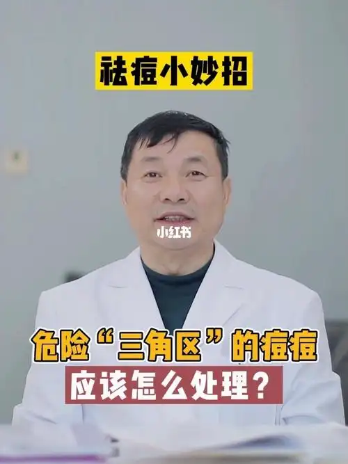 面部危险三角区的痘痘可以这么处理