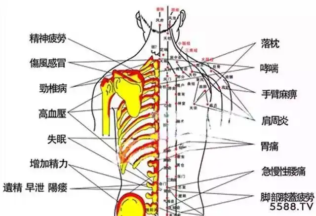 拔罐以后罐印不消为什么(拔罐留下的罐印反映了身体状况)(1)
