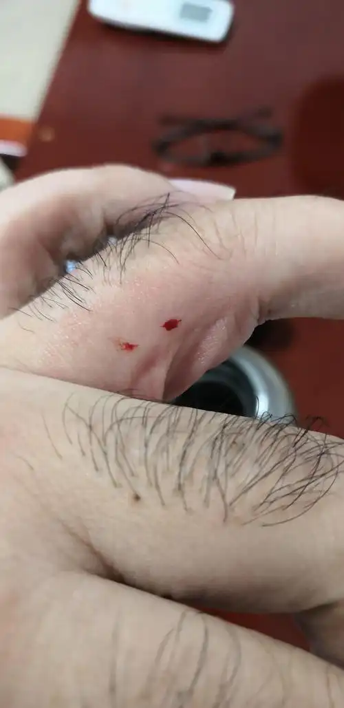 被蜈蚣咬到是怎么样的体验? - 知乎