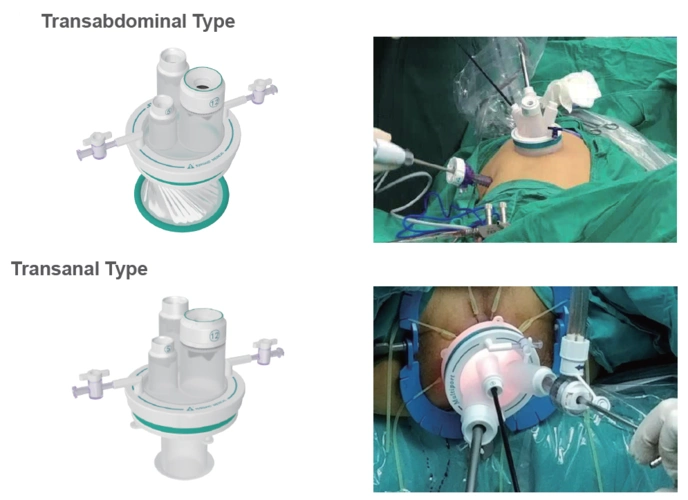 endoscopic and laparoscopic single port