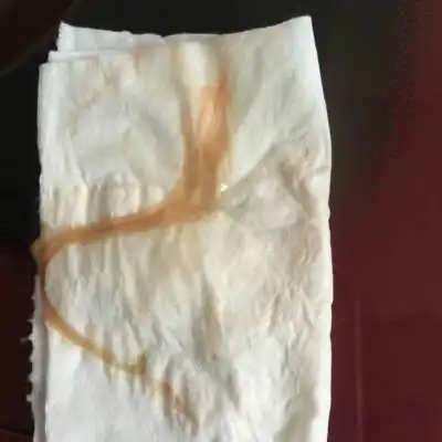 问答 怀孕期 推荐回答                     见红离生还早呢,一般没那