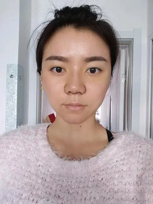 现在看着鼻头好大,还是很圆钝,侧面倒是看着比以前好多啦