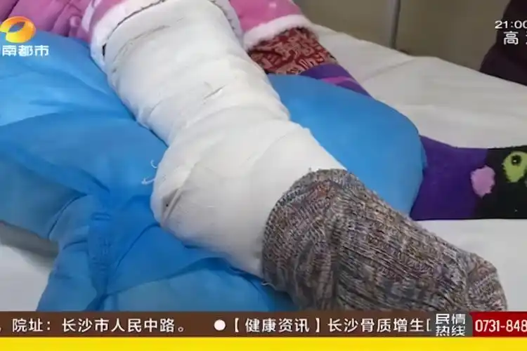 10岁女儿被游泳馆玻璃门划断脚筋,负责人拿果篮看望后竟不管了!