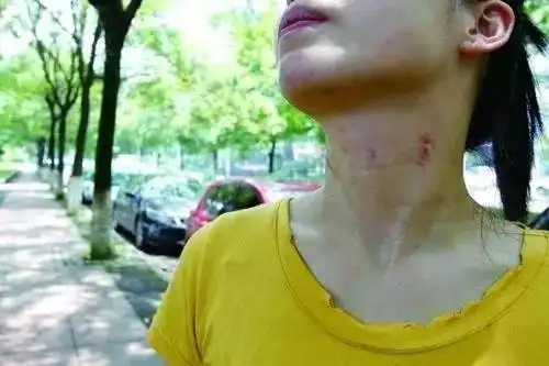 温州女子路边停宝马,却被"口罩男"一把掐住脖子
